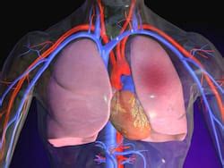 Pulmonary Embolism - REBEL EM - Emergency Medicine Blog