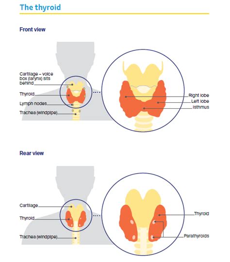 Understanding Thyroid Cancer: Symptoms, Types, and Risk Factors - Cancer Council Victoria ...