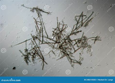 Mold filaments and spores stock image. Image of aspergillus - 248210583