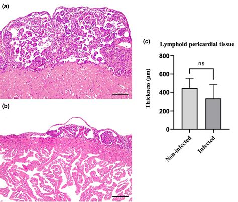 First detection of Flavobacterium psychrophilum in juvenile Siberian ...