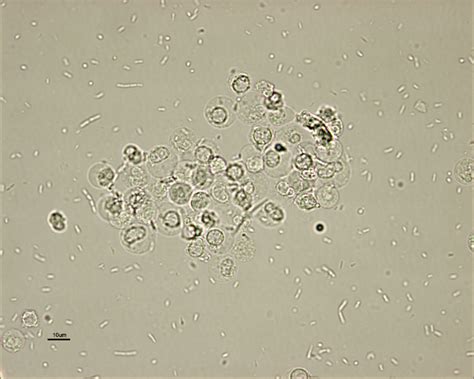 leukocytes+in+urine | Managing the E coli UTI Medical Laboratory Scientist, Ascp, Parasite ...