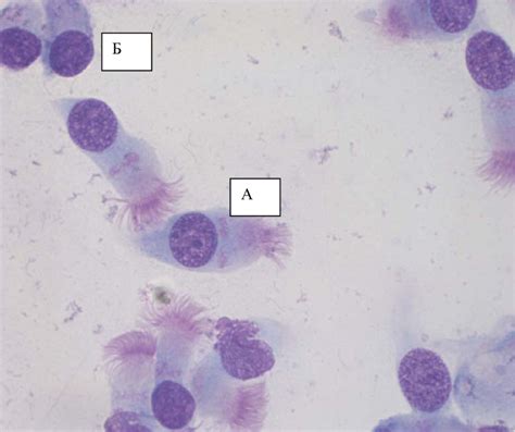 Brush microbiopsy of the nasal mucosa. Normal manifestations of ...