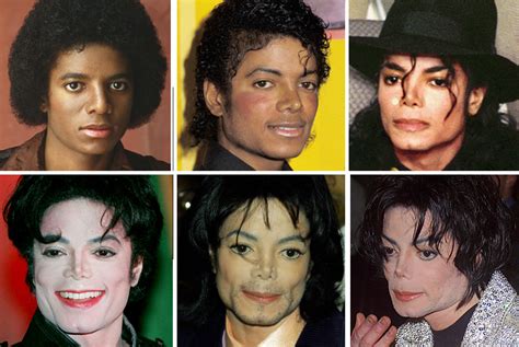 Michael Jackson's Plastic Surgery — See His Transformation