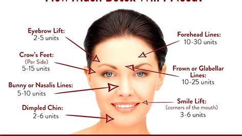 Botox Brow Lift Injection Sites - Lift Choices