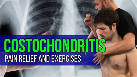 Costochondritis Pain