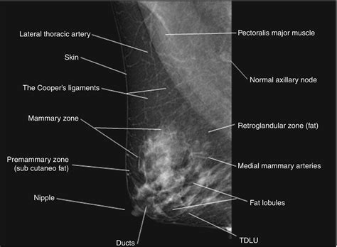Radiology Anatomy Images : Foot X-RAY Anatomy