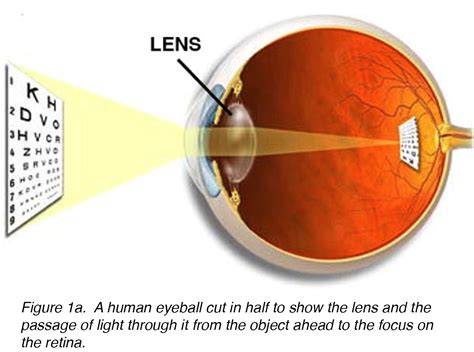 Crystalline Lens and Cataract by Joah F. Aliancy and Nick Mamalis – Webvision