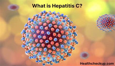 Hepatitis C - Symptoms, Diagnosis, Treatment, Prevention