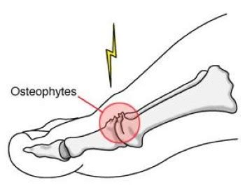 Big Toe Joint Anatomy - Anatomy Reading Source