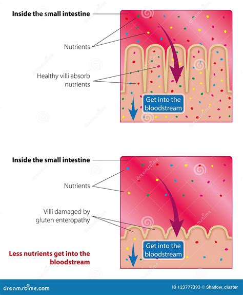 Absorption of Nutrients in the Small Intestine Stock Vector ...