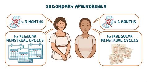 Approach to secondary amenorrhea: Clinical sciences - Osmosis Video Library