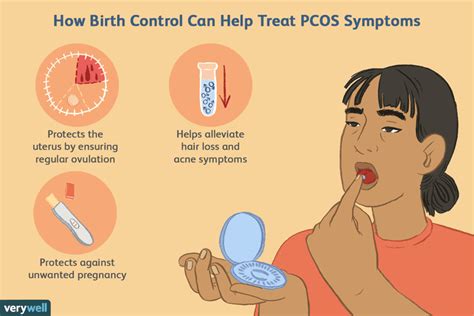 Using Birth Control to Treat PCOS