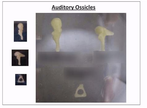 Ear (ossicles) Diagram | Quizlet