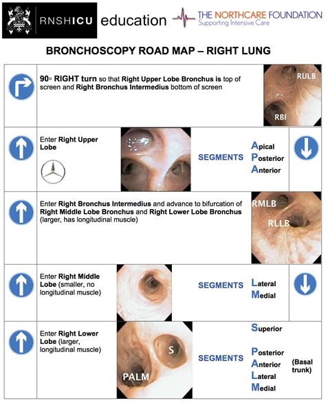 Bronchoscopy Road Map Right Lung - Critical Care Airway Management