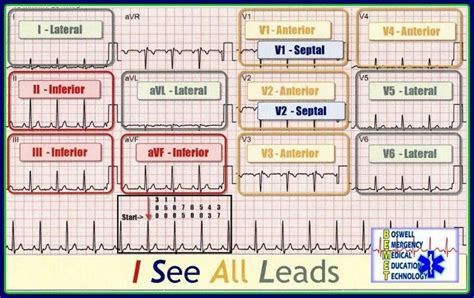 Pin by Katie Gagne on Nursing stuff | Nursing mnemonics, Emergency nursing, Nurse