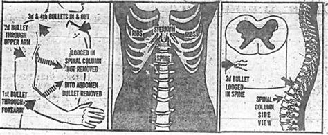 Presidential Candidate George Wallace is Shot 4 Times in an Assassination Attempt by a Supposed ...