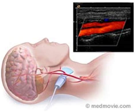 Non-Invasive Vascular Ultrasound