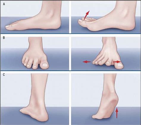 Home Remedies to Treat, Exercise, and Prevent Bunions | WalkJogRun