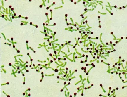 Cytoplasmic Granules of Bacteria and their significance