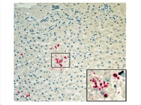 Immunohistochemical stain for Toxoplasma gondii confirms the diagnosis.... | Download Scientific ...