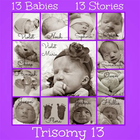 Trisomy 13: 13 Babies, 13 Stories | Still Playing School