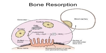 Bone Resorption - Assignment Point