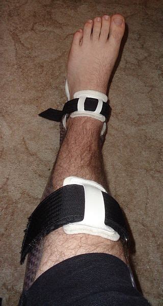 Difference Between Orthosis and Prosthesis | Compare the Difference ...