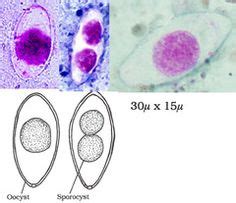 11 Isospora belli ideas | microbiology, protists, medical laboratory