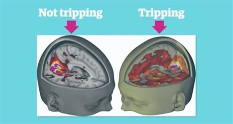 Amazing New Study Reveals LSD's Effects On The Brain