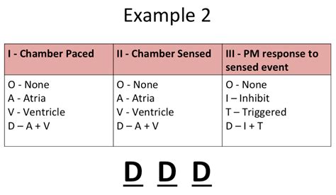 Pacemaker Essentials: What we need to know in the ED - CanadiEM