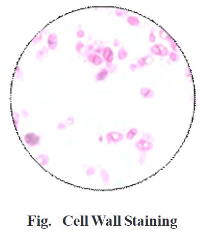 Cell Wall Staining: Principle and Procedure - Biology Ease