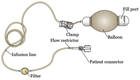 Continuous Infusion with Your Elastomeric Pump (2022)