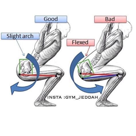 Lateral Tilt Of Pelvis