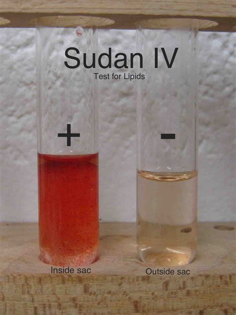 [Solved] Sudan IV lipid test lab report and background information | Course Hero