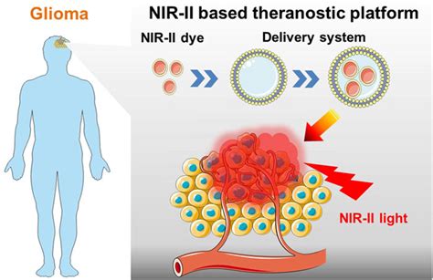 Frontiers | Recent advances in NIR-II fluorescence based theranostic approaches for glioma