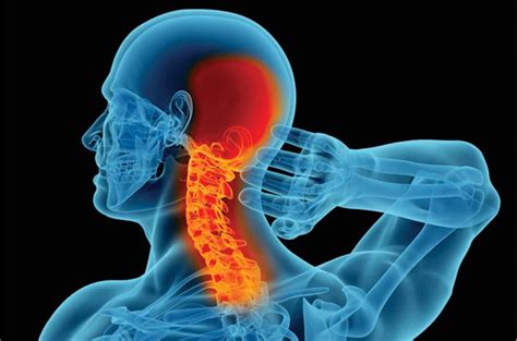 Understanding Neck Pain: Causes, Symptoms, and Treatment Options ...