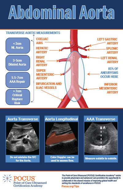 Abdominal Aorta Ultrasound