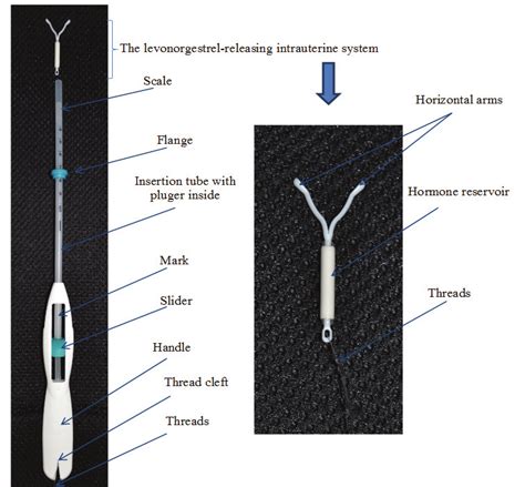 The levonorgestrel-releasing intrauterine system and inserter ...