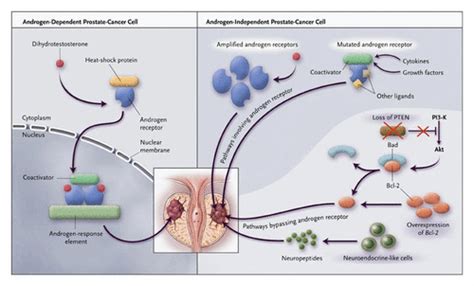 Mechanisms of Androgen-Refractory Prostate Cancer | NEJM