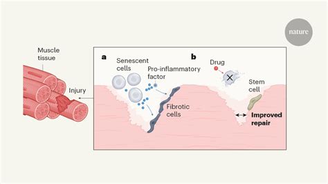 Senescent cells damage the body throughout life