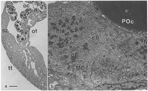 Ovotestis of one-year-old juveniles with testicular and ovarian ...