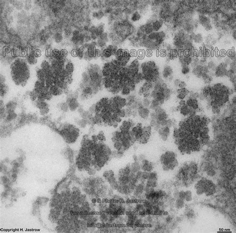 glycogen granules Dr.Jastrow's electron microscopic atlas