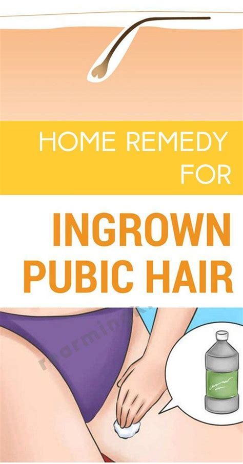 Home Remedy For Ingrown Hair #hairlosshomeremedies #IngrownHairScrub #IngrownHairRemedies ...