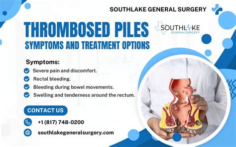 Thrombosed Piles: Symptoms And Treatment Guide - Southlake General Surgery