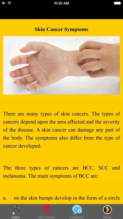 Skin Cancer Symptoms - Warning Signs by Inga Berga