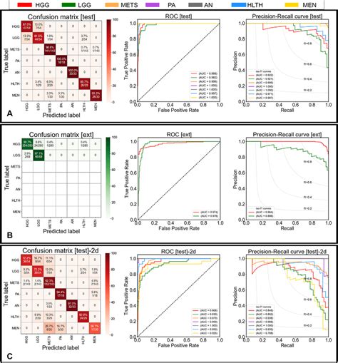 Confusion matrix, receiver operating characteristic (ROC) curve, and ...