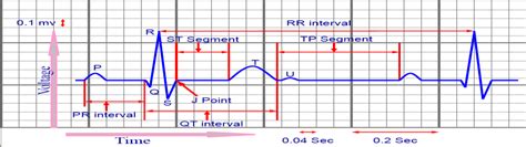 Fajarv: P R Interval Ecg