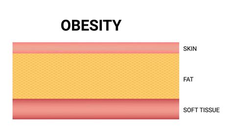 Premium Vector | Layers of skin diagram illustration vector on white background medical ...