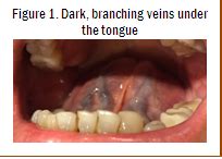 Does Under Your Tongue Look Like This? | Depke Wellness