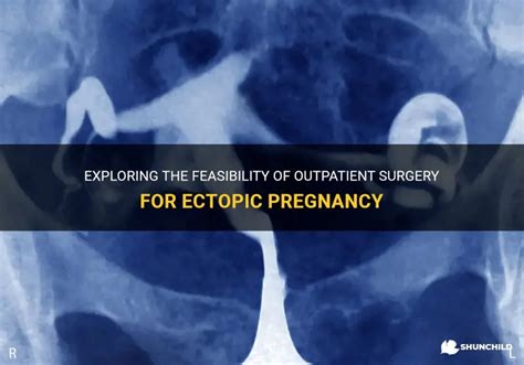 Exploring The Feasibility Of Outpatient Surgery For Ectopic Pregnancy | ShunChild